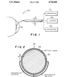 U.S. Patent No. 4,744,360